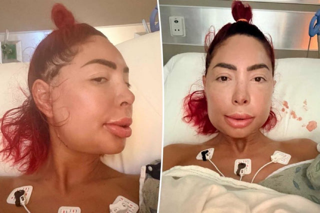 Farrah Abraham Has Stitches Removed After Jaw Surgery But Faces Long Recovery, Significant Weight Loss